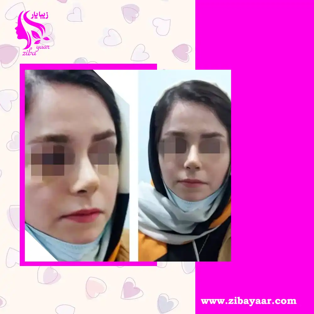 نمونه عکس عمل دکتر عبدالرسول ملاح زاده